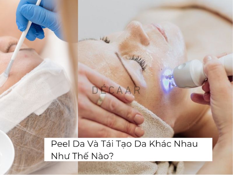 peel da và tái tạo da khác nhau như thế nào